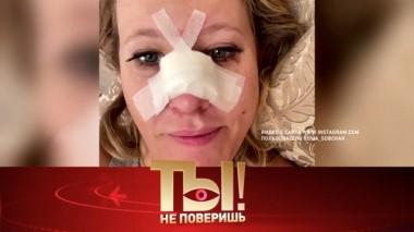 Кто сломал нос Ксении Собчак и почему разводятся Харламов и Асмус? 27.06.2020