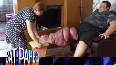 «Нога-гигант»  24.09.2024
