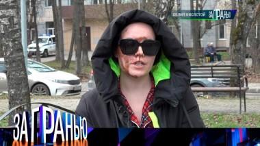 «Облил кислотой» 24.04.2024