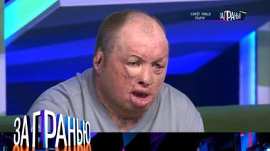 «Сжёг лицо сыну» 15.09.2025
