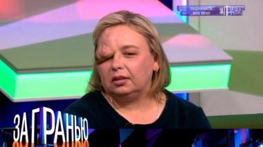 «Поднимите мне веко» 16.06.2022